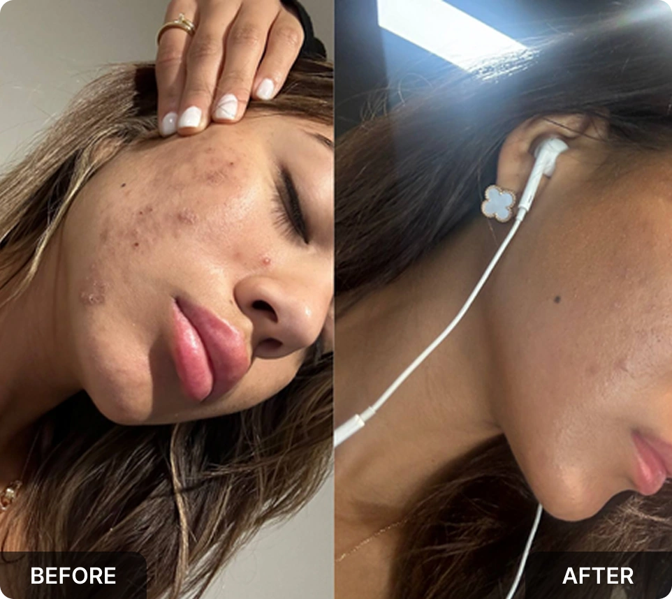 Before and after